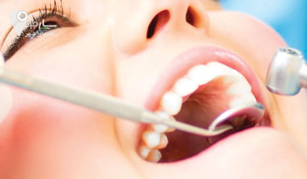 پاسخ به سوال یک دندانپزشک در شیراز چه خصوصیاتی دارد؟ برای کاربران سایت - دندانپزشک شیراز