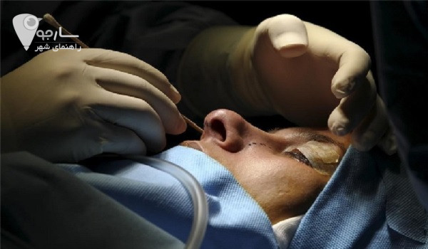 جراحی بینی شیراز | دکتر بینی شیراز