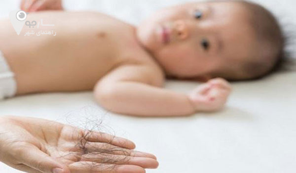 ریزش مو در دوران شیردهی طبیعی میباشد .