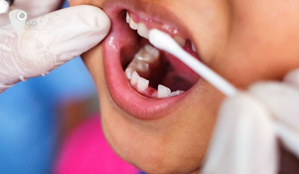 دندانپزشک کودکان در شیراز